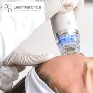 Microneedling and radio frequency reduces fine lines and wrinkles on the face.